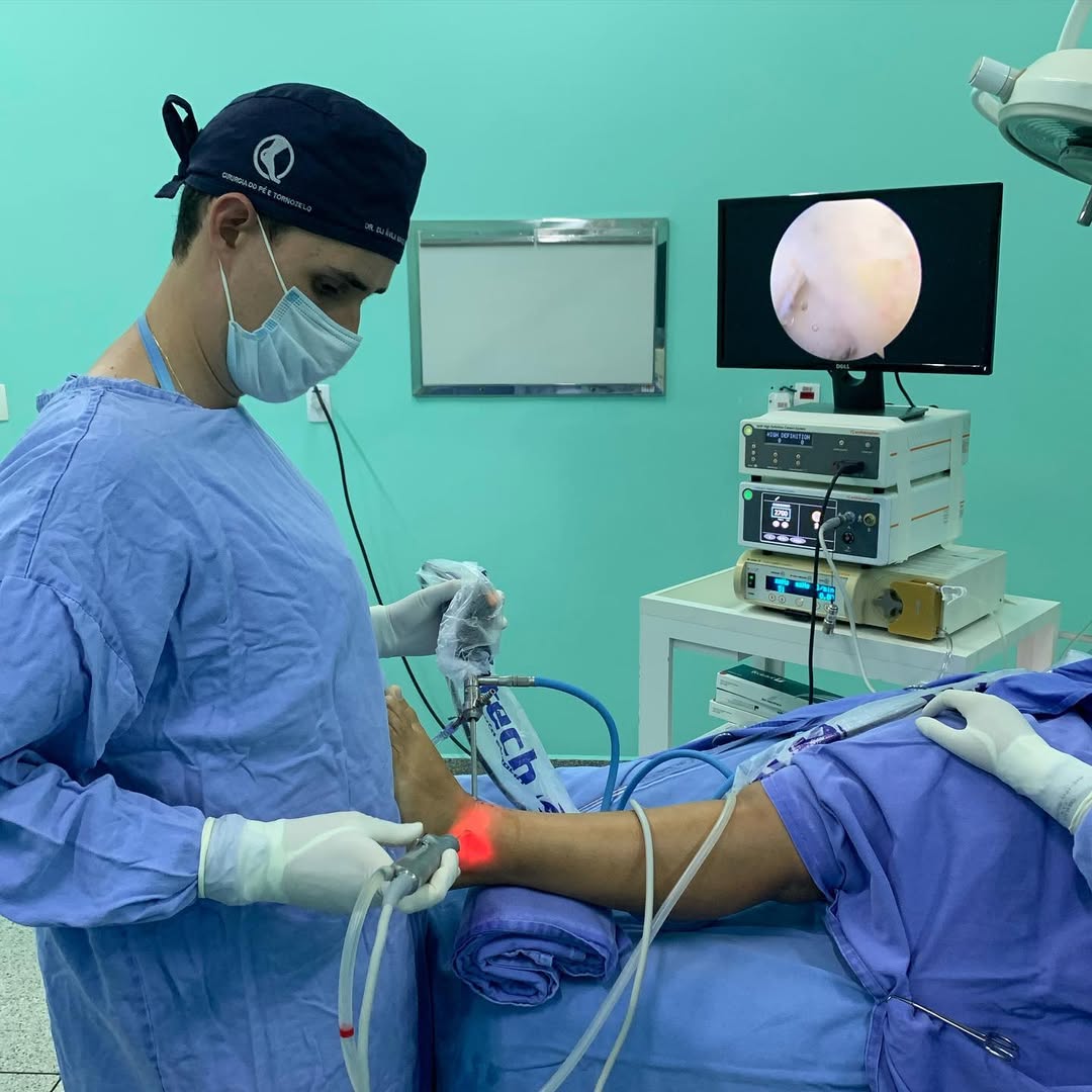 Dr. Eli Ávila realizando artroscopia do tornozelo